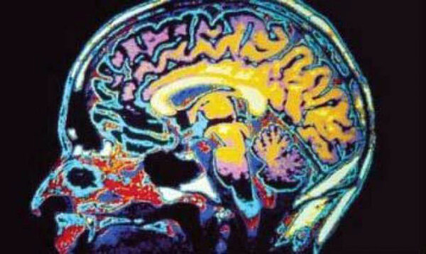 Marijuana’s impact on the brain: Does highly-potent marijuana cause mental health issues?